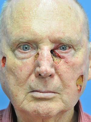 Reconstruction Before & After