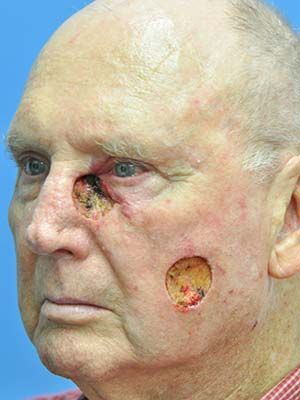 Reconstruction Before & After