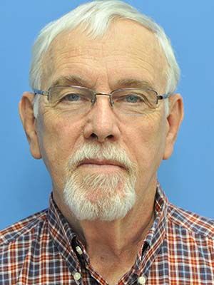 Reconstruction Before & After