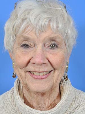 Reconstruction Before & After