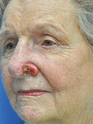 Reconstruction Before & After