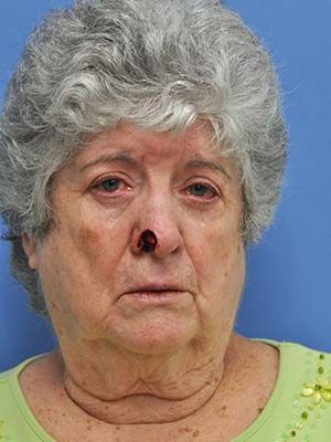 Reconstruction Before & After