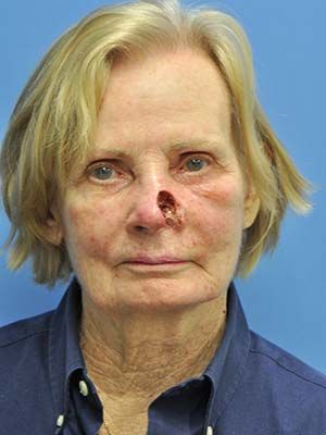 Reconstruction Before & After