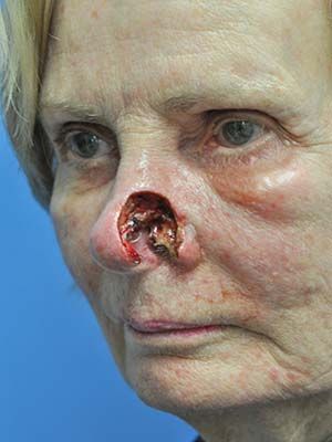 Reconstruction Before & After