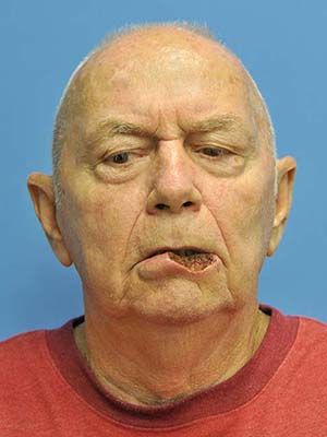 Reconstruction Before & After