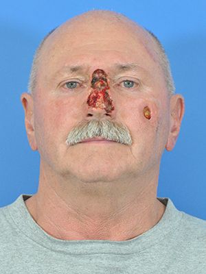 Reconstruction Before & After