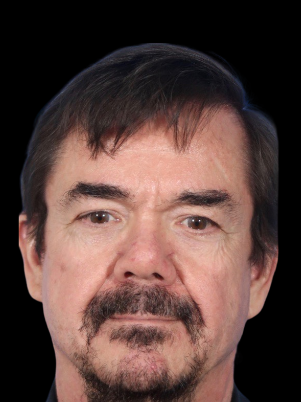 Blepharoplasty Before & After