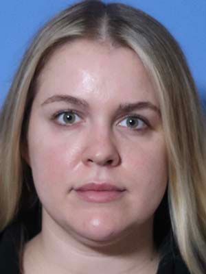 Facetite Before & After