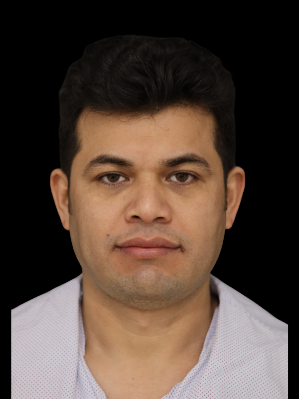 Facetite Before & After