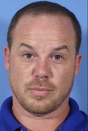 Hair Loss Restoration Before & After