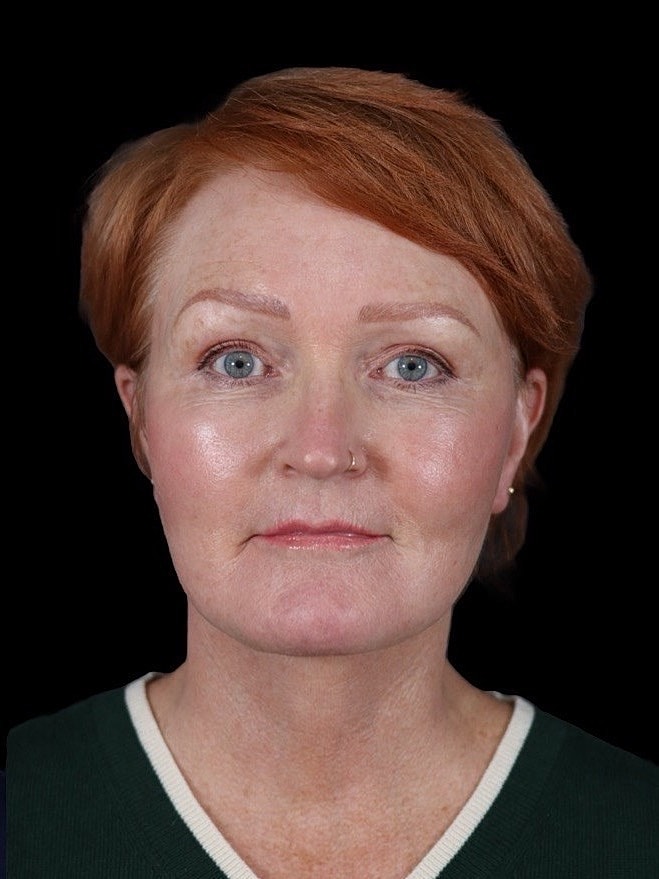 Woman with short red hair, neutral expression.